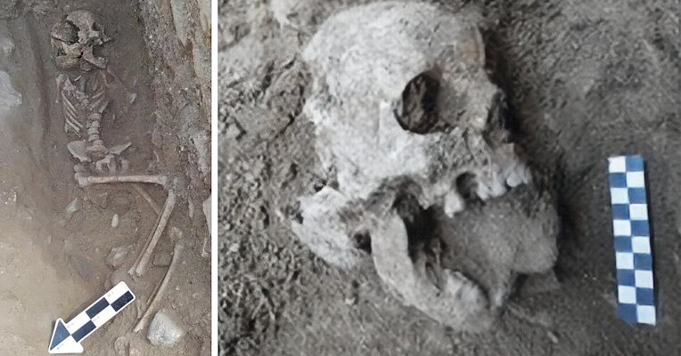 Scheletro umano parzialmente sepolto e primo piano del cranio danneggiato con una pietra nella bocca e  scala metrica accanto.